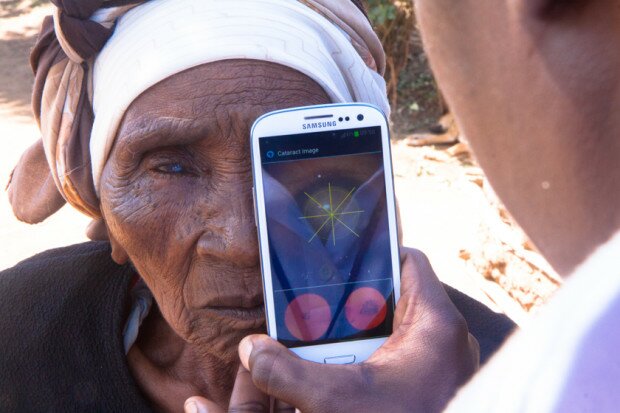 Cataract testing outside patients home_3 Â© Peek